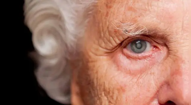 La ceguera se produce por varias causas, como los accidentes, la diabetes y ciertas enfermedades oculares.