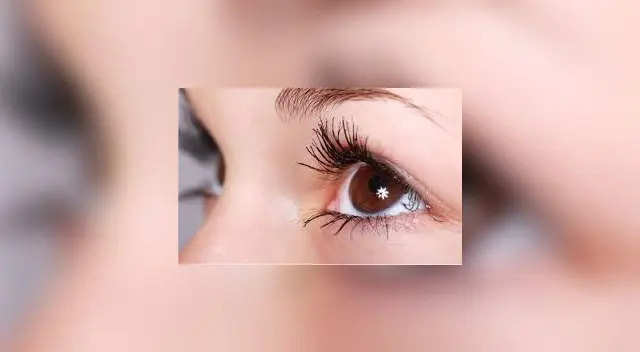 La ceguera puede producirse repentinamente o de manera gradual. A menudo, no hay dolor.