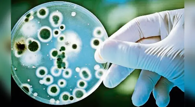 ¿Qué es y cuáles son los síntomas de la brucelosis?