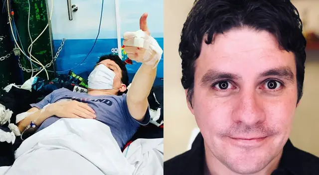 Germán Loero sufrió accidente de tránsito.