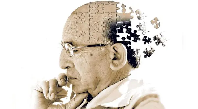 La enfermedad de Alzheimer (EA), denominada demencia senil de tipo Alzheimer (DSTA) o simplemente alzheimer.