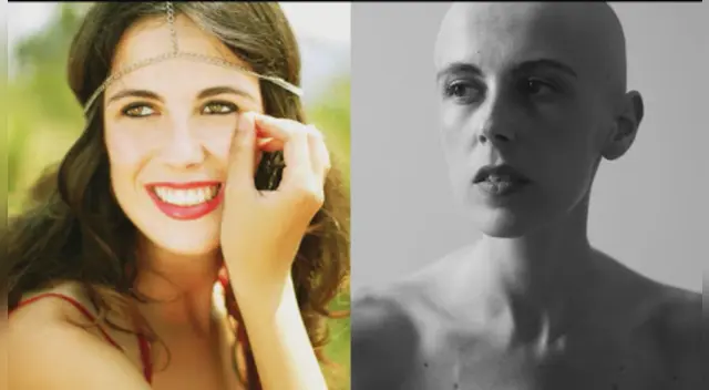 La joven está luchando contra el cáncer gástrico en medio de la pandemia de coronavirus. La joven está luchando contra el cáncer gástrico en medio de la pandemia de coronavirus.