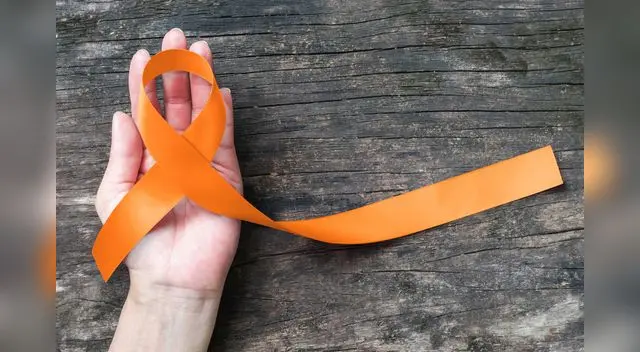 Por lo general, el paciente puede presentar de manera progresiva cansancio. Por lo general, el paciente puede presentar de manera progresiva cansancio.