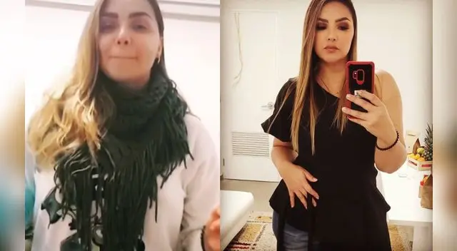 Vernis Hernández se hará cirugía bariátrica tras subir 20 kilos Vernis Hernández se hará cirugía bariátrica tras subir 20 kilos