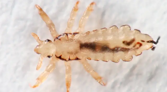 El agente de Georgia indicó que las picaduras repetidas de los piojos redujeron los niveles de hierro de la niña. El agente de Georgia indicó que las picaduras repetidas de los piojos redujeron los niveles de hierro de la niña.