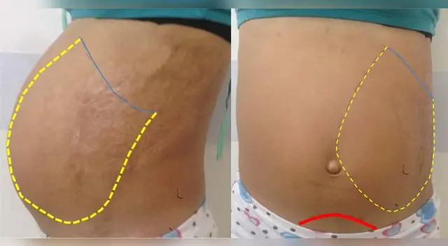 Esta enfermedad no tiene una sola manifestación medica.