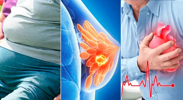 “Abordar el COVID-19 significa tratar la hipertensión, la obesidad, la diabetes, las enfermedades cardiovasculares y respiratorias crónicas y el cáncer”, indicó el científico.