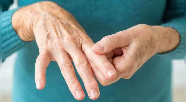 Entre el 26 a 60% de pacientes se ven obligados a  abandonar sus trabajos.