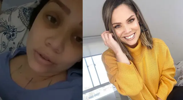 Andrea San Martín cuenta cómo le fue en su operación estética.