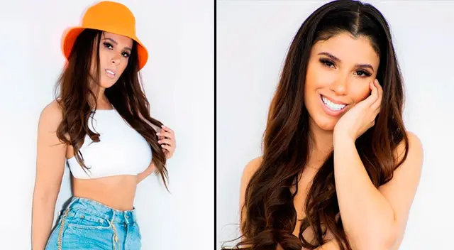 Yahaira Plasencia se hizo un aumentó de labios en Miami.