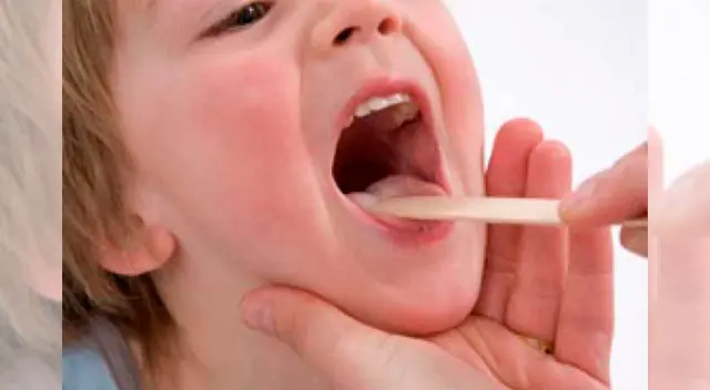 Imagen referencial. Imagen referencial.