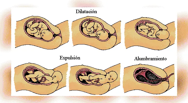 El parte tiene tres fases: dilatación, expulsión y alumbramiento.