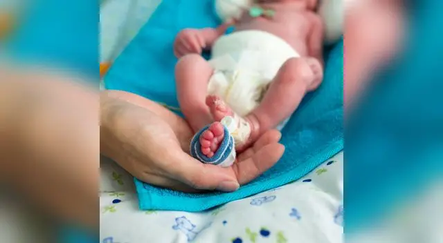 Se considera a un niño prematuro a todo aquel que nace antes de las 37 semanas de gestación.