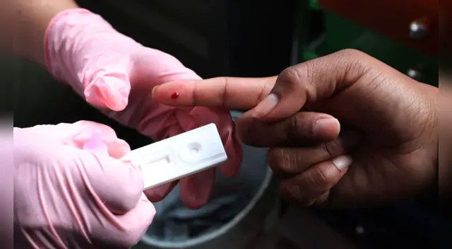 OMS afirma que 690,000 personas murieron por causas relacionadas con el VIH en 2019.