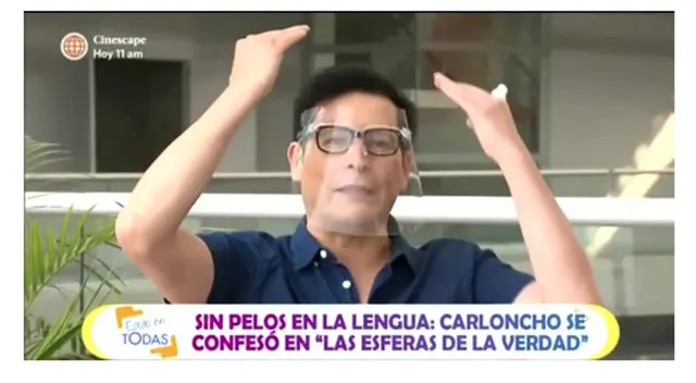 Carloncho confiesa que se ha hecho ‘retoquitos’: “Me hice el reacomodo de pelo” Carloncho confiesa que se ha hecho ‘retoquitos’: “Me hice el reacomodo de pelo”