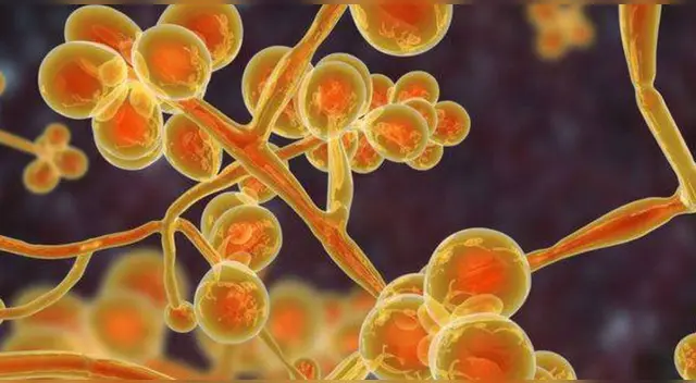 Entérate aquí cómo puedes prevenir la infección por candida auris. Entérate aquí cómo puedes prevenir la infección por candida auris.