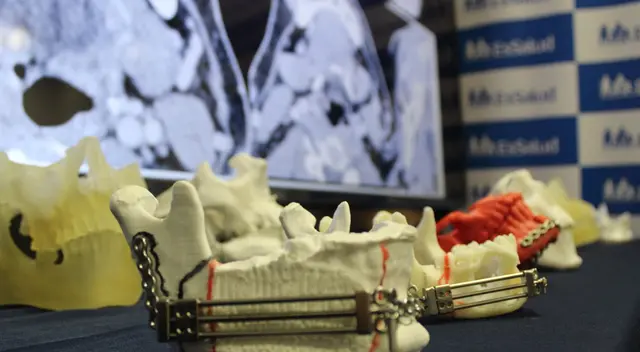 Moderna tecnología en EsSalud. Moderna tecnología en EsSalud.