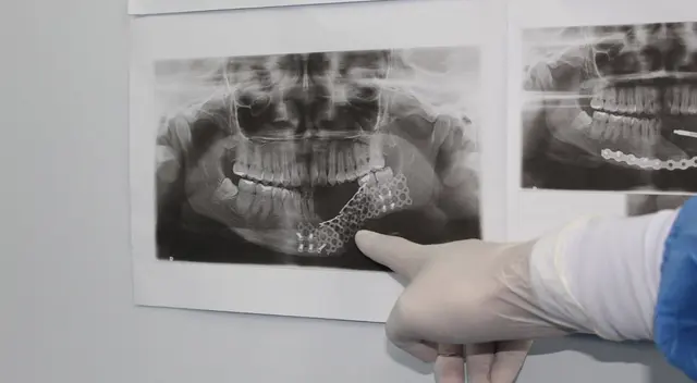 Moderna tecnología en EsSalud. Moderna tecnología en EsSalud.