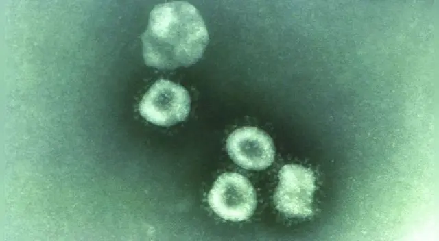 La variante de Reino Unido tiene mutaciones en la proteína S. La variante de Reino Unido tiene mutaciones en la proteína S.