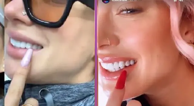 Leslie Shaw se colocó otro diamante en sus dientes siguiendo la moda entre los artistas urbanos. Leslie Shaw se colocó otro diamante en sus dientes siguiendo la moda entre los artistas urbanos.