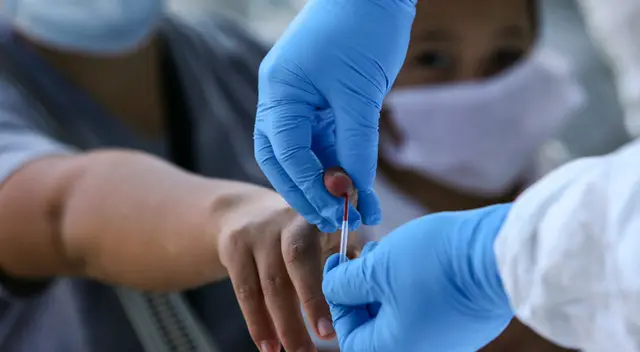 OMS desea conocer el origen de la pandemia. OMS desea conocer el origen de la pandemia.