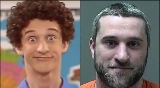 Dustin Diamond de “Salvado por la campana” fue diagnosticado con cáncer tras ingresar de emergencia a hospital