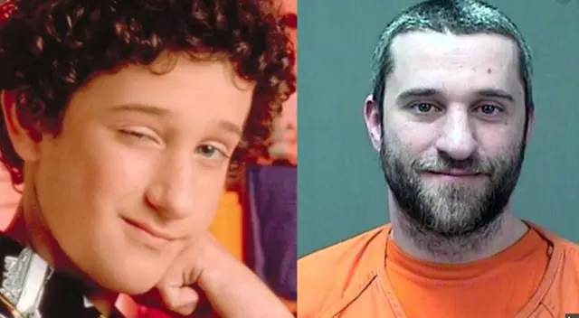 Dustin Diamond de “Salvado por la campana” fue diagnosticado con cáncer tras ingresar de emergencia a hospital