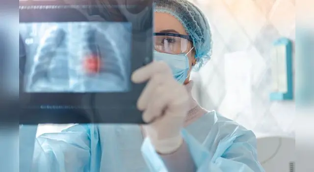 "No sé quién necesita escuchar esto, pero los pulmones después del covid-19 se ven peor que cualquier tipo de pulmón de fumador terrible que hayamos visto", dijo.