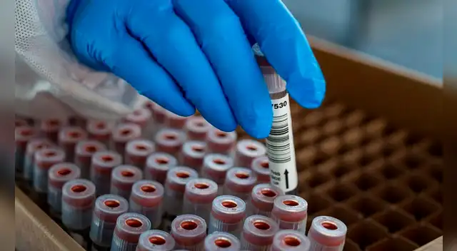 De acuerdo a especialistas, la cepa sudafricana es más transmisible.