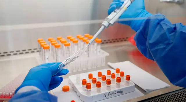 El proyecto tuvo el respaldo financiero del programa Innóvate Perú del Ministerio de la Producción, y el acompañamiento del Centro de Excelencia de la Universidad San Marcos. El proyecto tuvo el respaldo financiero del programa Innóvate Perú del Ministerio de la Producción, y el acompañamiento del Centro de Excelencia de la Universidad San Marcos.