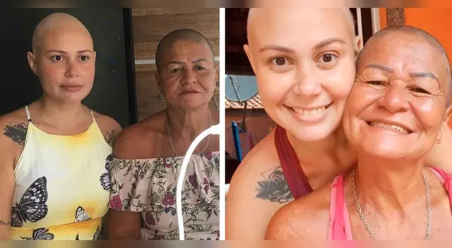 La madre no quiso que su hija pasara sola por el trance de lucir con la cabeza rapada.