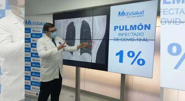 Daños en los pulmones por el COVID-19.