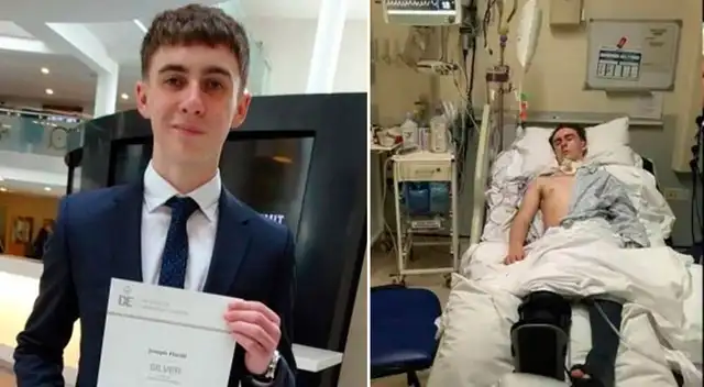 Joseph Flavill, de 19 años, sufrió un atropello en marzo de 2020.