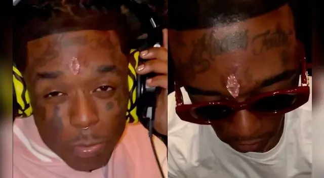 El rapero Lil Uzi Vert se implantó un diamante en la frente. El rapero Lil Uzi Vert se implantó un diamante en la frente.