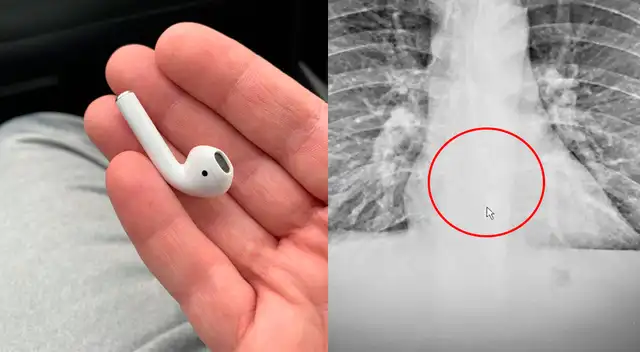 El hombre se fue a dormir con los AirPods puestos.