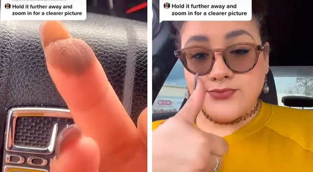 La joven empezó a notar esto tras llegar a la pubertad