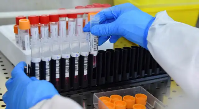 El fármaco cubano ha logrado disminuir la cifra de enfermos graves por el coronavirus.