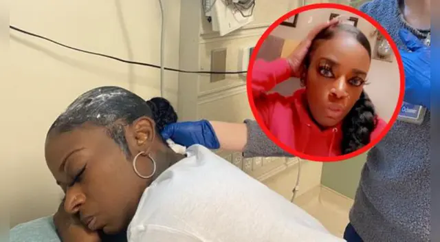 EE. UU.: El dramático caso de una tiktoker que usó pegamento en lugar de laca para el cabello