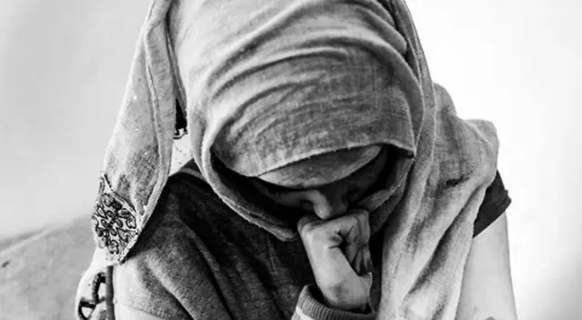 La joven tendrá que someterse a tres cirugías plásticas, las intervenciones, además de complejas, son costosas. La joven tendrá que someterse a tres cirugías plásticas, las intervenciones, además de complejas, son costosas.