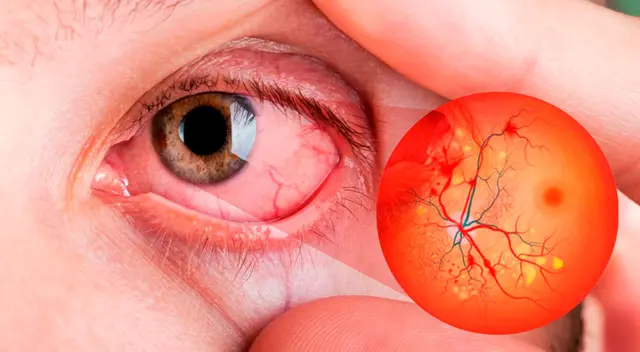 La Sociedad Francesa de Neuroradiología realizó un estudio con 129 pacientes con covid-19 grave. La Sociedad Francesa de Neuroradiología realizó un estudio con 129 pacientes con covid-19 grave.
