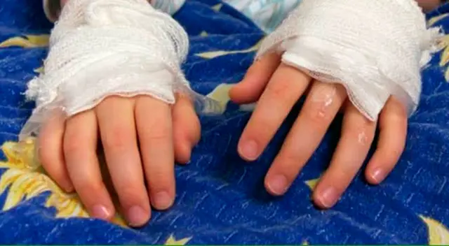 mujer es detenida tras ser acusada de quemar las manos de sus hijos mujer es detenida tras ser acusada de quemar las manos de sus hijos