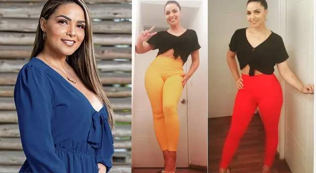 Vernis Hernández preocupada tras bajar 21 kilos por la manga gástrica