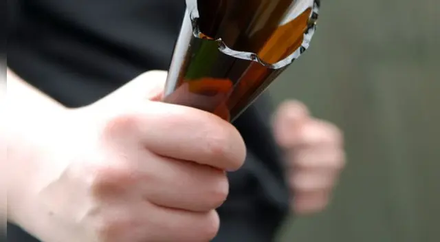 joven terminó desfigurado tras resistirse al robo joven terminó desfigurado tras resistirse al robo