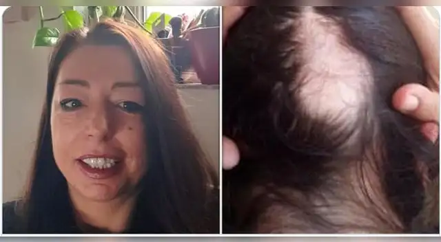 Abby Read, de 45 años y residente en el condado inglés de Devon, cree que se contagió en marzo del 2020, pero no había desarrollado ningún síntoma. Abby Read, de 45 años y residente en el condado inglés de Devon, cree que se contagió en marzo del 2020, pero no había desarrollado ningún síntoma.