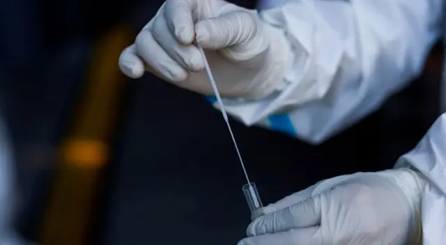 Las autoridades aseguran que los rastros del virus que se encuentran en el ano pueden durar más que en el tracto respiratorio. Las autoridades aseguran que los rastros del virus que se encuentran en el ano pueden durar más que en el tracto respiratorio.