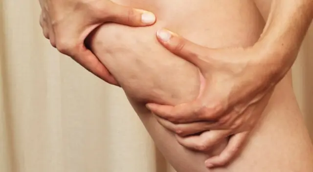 Una buena alternativa natural.