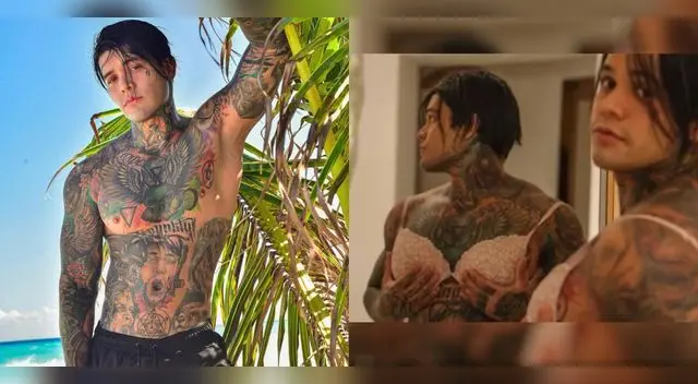 Yeferson Cossio, influencer colombiano, se puso implantes de silicona para cumplir apuesta.