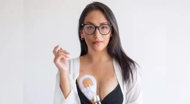 Indyra Oropeza, de Con L de Leucemia, recordó que el cáncer no es una sentencia de muerte, y que puede ser tratado si se encuentra a tiempo.