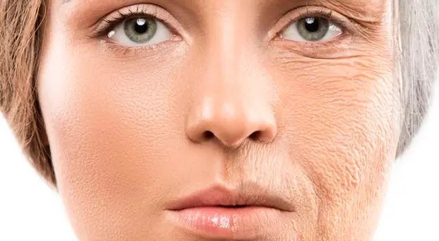 El colágeno hidrolizado es un suplemento alimenticio que se prepara a partir de los huesos y del cartílago del ganado vacuno.