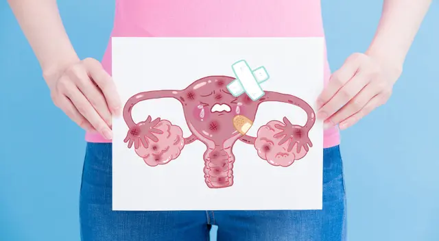 Se proyecta incremento de casos. Cerca de 5 mil peruanas serán diagnosticadas con la enfermedad para el 2025 si no se realizan urgentes medidas de prevención.